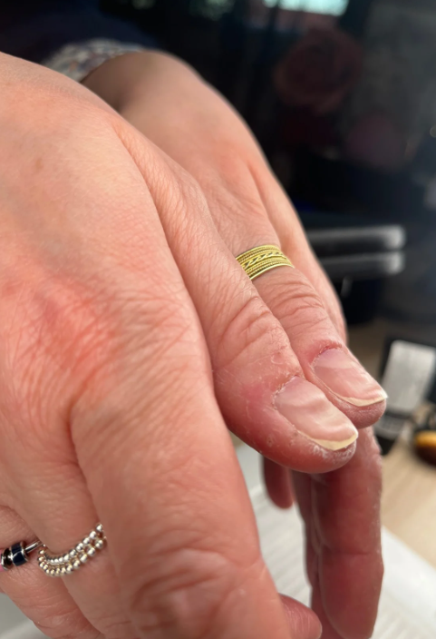 Mains d'une cliente à l'institut de beauté d'Alfortville, France, prêtes pour un soin de bien-être personnalisé et attentionné.